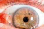 Eyeball, Iris, Lens, Pupil, Eyelash, Cornea, Sclera, HAEV01P04_07