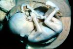 Human Embryo, Fetus, Embryo, HAIV01P04_17