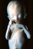 Fetus, Embryo, HAIV01P07_04