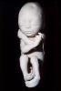 Fetus, Embryo, HAIV01P08_03