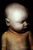 Fetus, Embryo, HAIV01P08_17