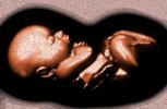 Fetus, Embryo, HAIV01P09_11B