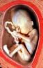 Womb, Uterus, Fetus, HAIV01P11_04B