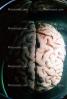Real Human Brain, HANV01P04_05