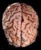 Real Human Brain, HANV01P04_16