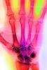 hand, fingers, knuckles, X-Ray, HASV01P08_09B