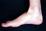 Foot, Toes, Joints, Ankle, Heal, Skin, Epidermis, HASV01P15_14