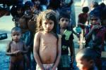 Malnourished Girl, Malnutrition, Hungry, Ribs, Slums, PLPV03P12_17