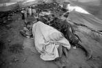 Tuberculosis, Refugee Camp, near the Ethiopia Somalia border, African Diaspora, Somalia, POV35V07P44_07