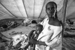 Tuberculosis, Refugee Camp, near the Ethiopia Somalia border, African Diaspora, Somalia, POV35V07P44_10