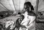 Tuberculosis, Refugee Camp, near the Ethiopia Somalia border, African Diaspora, Somalia, POV35V07P44_12