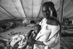 Tuberculosis, Refugee Camp, near the Ethiopia Somalia border, African Diaspora, Somalia, POV35V07P44_13