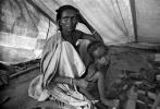 Tuberculosis, Refugee Camp, near the Ethiopia Somalia border, African Diaspora, Somalia, POV35V07P44_20