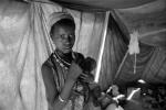 Tuberculosis, Refugee Camp, near the Ethiopia Somalia border, African Diaspora, Somalia, POV35V07P44_31